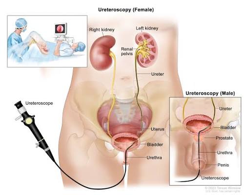 Anatomy of the distal and proximal urethra