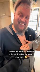 Jelly Roll's Weight Loss Transformation Before and After [Photos]