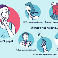 Today, i am tackling how to get rid of milia, those hard white bumps for you! 6 Steps To Heal A Big Pimple That Won T Go Away
