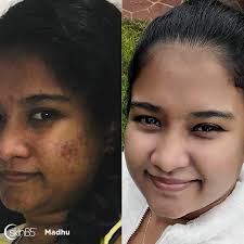 Testimonials and Results