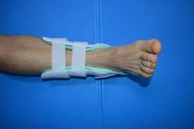 We did not find results for: Sprunggelenkbandage Und Fussschiene