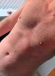 Maybe you would like to learn more about one of these? Is My Skin Rash A Covid 19 Symptom