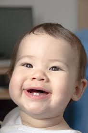 Iléus Synopsis Photographies