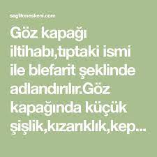 Goz Kapagi Iltihabi Tiptaki Ismi Ile Blefarit Seklinde Adlandirilir Goz Kapaginda Kucuk Sislik Kizariklik Kepeklenme Ve Capaklanma 2020 Saglikli Yasam Tip Saglikli