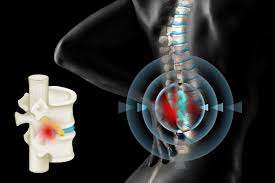 Image result for vyhřezlá ploténka