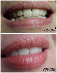 Blog Protege Connexion Blanchir Les Dents Blanchir Les Dents Naturellement Astuce Dent Blanche