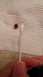 But not safe to use way past its expiration date like. How To Get Rid Of Earwax Buildup Reddit