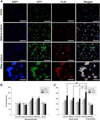 Check spelling or type a new query. Effect Of Sugar Molecules On The Cryopreservation Of Mouse Spermatogonial Stem Cells Fertility And Sterility