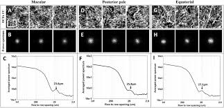 The 200 cc bikes in india are fast becoming popular, especially with the youth who want a motorcycle that offers decent enough performance without being too heavy on the pocket in terms of. Power Spectrum Analysis Of The Inter Capillary Distance For Macular Cc Download Scientific Diagram