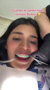 Ligas Corridas Dobles en Brackets: Todo lo que Debes Saber