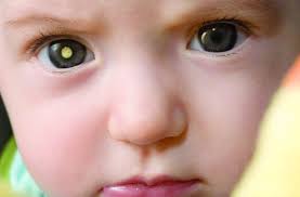 If your baby can't make steady eye contact by this time or seems unable to see, let your child's doctor know. Retinoblastoma The Signs Symptoms And Solutions Ocular Prosthetics Inc