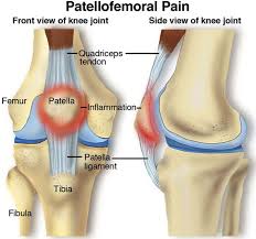 Pin On How To Relief