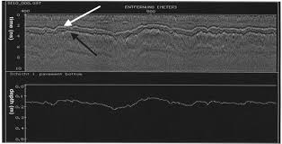 Mit dem schichtplan für android hast du deinen schichtplan immer bei dir. Concrete Bridge Inspection With A Mobile Gpr System Sciencedirect