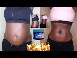 Pin On Home Remedies