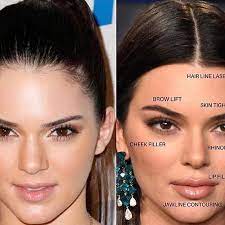 Tag us in or send us you're results #competition #aestheticallyyou #skin #injectables #lips. Epingle Sur ××©××××