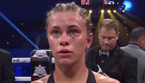 Vanzant is signed to the flyweight division of the ultimate fighting championship. Auqfuwns27g2bm