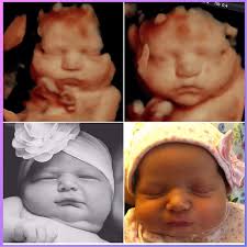3d 4d baby ultrasound and photography also offers early gender dna detection tests offered to women starting at 9 weeks into pregnancy. 3d Ultrasound Testimonials 3d 4d Ultrasound In Ft Myers Fl