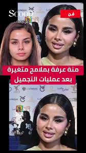 منة عرفة بملامح متغيرة بعد عمليات التجميل