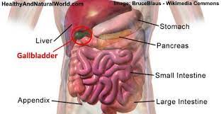 Researchers Reveal 10 Foods To Avoid After Gallbladder Surgery Gallbladder Gallbladder Surgery After Gallbladder Surgery