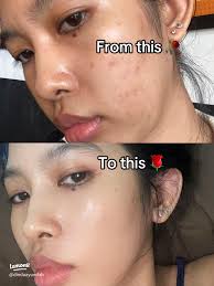 55 ide Menyembuhkan Pie Dan Poh teratas di 2025