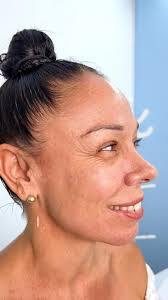 ¡Transforma tu apariencia con la magia de la , 𝐓𝐎𝐗𝐈𝐍𝐀  𝐁𝐎𝐓𝐔𝐋𝐈́𝐍𝐈𝐂𝐀!👩‍⚕️💉, 💁‍♀️ Más conocida como botox, mejora la  estética del paciente brindando un aspecto más relajado del rostro y  corrigiendo las ...