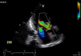 Ultrasound Doppler Principles Preparation Results And More