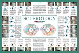 the best sclerology chart free for iridology chart