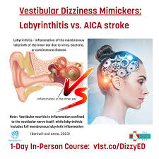 Image result for Bacterial Labyrinthitis