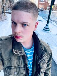 Hi all! I'm Logan, a 26 year old disabled transman from Ireland looking for  help with my gofundme to get top surgery which for me will be a life  changing and saving