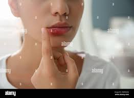 Swollen appearance hi-res stock photography and images