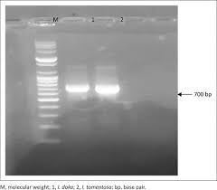 Image result for Isoberlinia doka