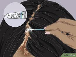 These fungi can eat dead skin. 3 Ways To Grow Hair Back After A Scalp Fungal Infection Wikihow