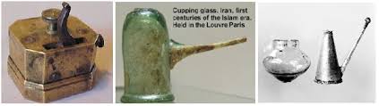 History of Cupping - Cupping TherapyCupping Therapy