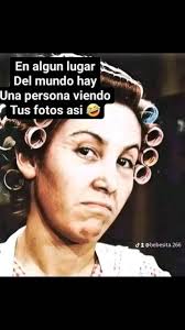 Le picaron abejas en el brazo jajajajaa