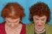First Signs Of Hair Thinning