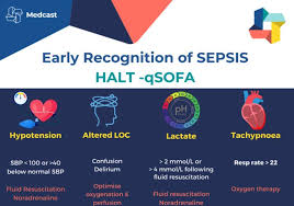 Image result for qSOFA Score