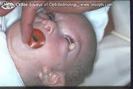 Der icd10 ist eine internationale klassifikation von diagnosen. Atlas Of Ophthalmology