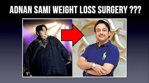 Did Adnan Sami Become Lean By Having Weight Loss Surgery