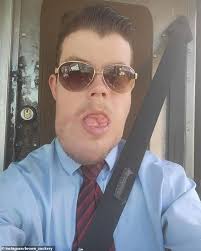 Man born with rare condition that made face deformed reveals he can lose  ability to speak to fix it