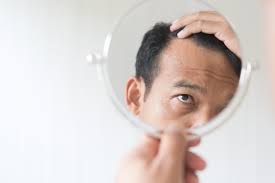 Hair loss treatment options for men and women are abundant. Busting Myths About Hair Loss