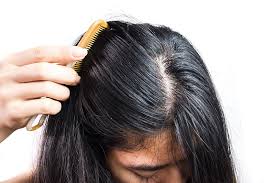 If you have oily hair, you probably find that you want to shampoo your hair almost every day. Oil Control Shampoo The Ultimate Solution For Greasy Hair Petal Fresh