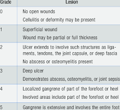 Image result for IDSA Diabetic Foot Wound Classification