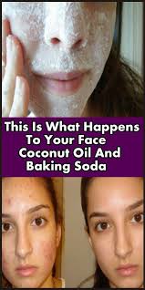 This Is What Happens Your Face After You Wash It With Coconut Oil And Baking Soda In 2020 Baking Soda Shampoo Baking Soda Beauty Hacks
