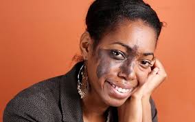 If my face upsets you, it's your problem not mine