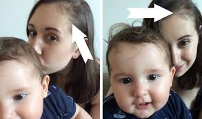سبب تساقط الشعر بعد الولادة و متي يتوقف لـ الام المرضع بشرة وشعر Postpartum Hair Loss Hair Loss Causes Hair Loss
