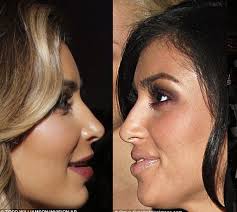 So Kim Kardashian Had A Nose Job Kardashian Plastic Surgery Kim Kardashian Before Nose Job