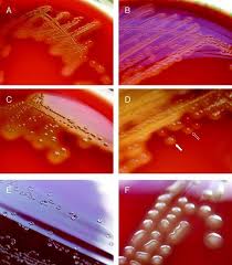 Image result for Group D Streptococcus