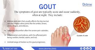 Image result for gout symptoms toe
