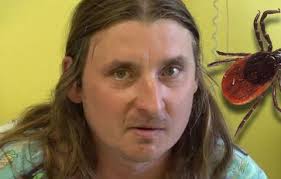 Klíšťová encefalitida vyvolala u pacienta vážné halucinace