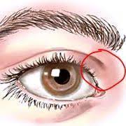 Diese tipps gegen eine trockene nase geben antwort darauf, was zu tun ist: Starke Schmerzen Zwischen Auge Und Nase Augen Kopfschmerzen